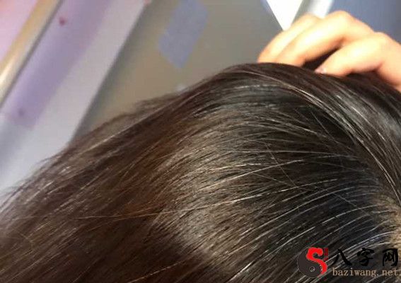 梦见自己头顶没头发